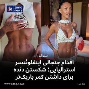 اقدام جنجالی اینفلوئنسر استرالیایی؛ شکستن دنده برای داشتن کمر باریک‌تر
