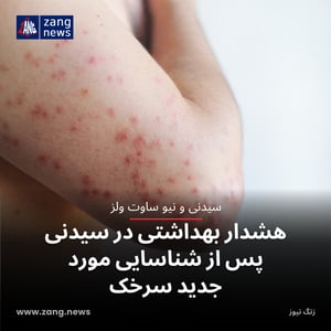 هشدار بهداشتی در سیدنی پس از شناسایی مورد جدید سرخک