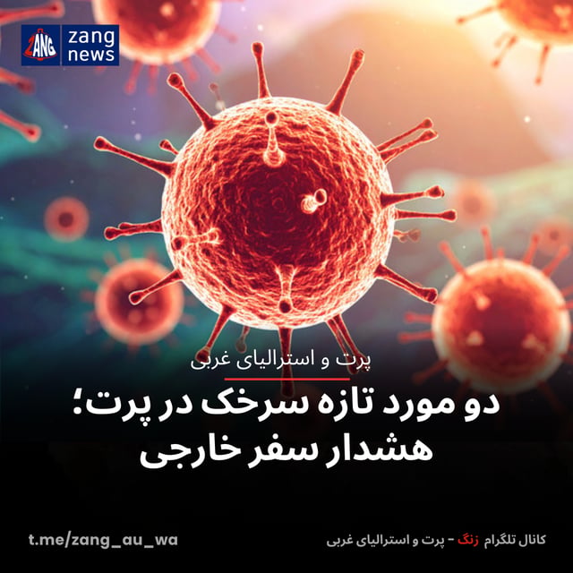 دو مورد تازه سرخک در پرت؛ هشدار سفر خارجی