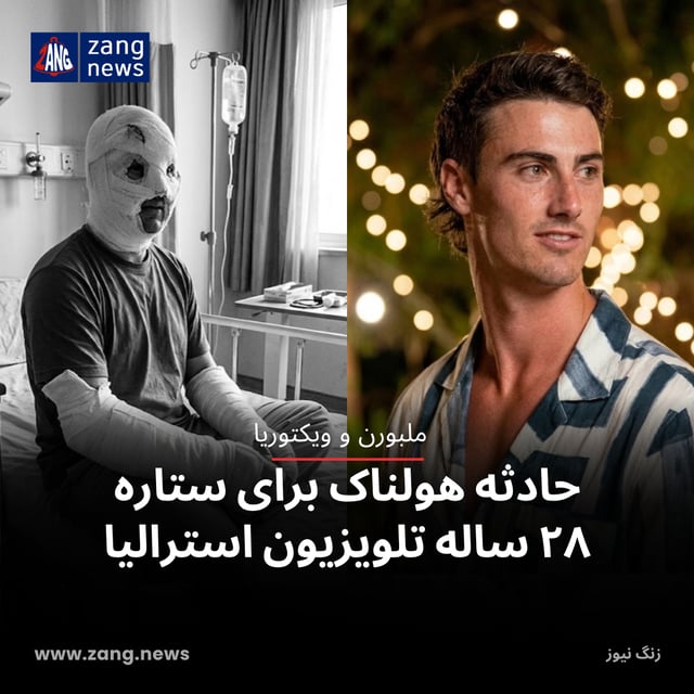حادثه هولناک برای ستاره ۲۸ ساله تلویزیون استرالیا