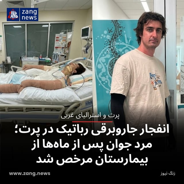 انفجار جاروبرقی رباتیک در پرت؛ مرد جوان پس از ماه‌ها از بیمارستان مرخص شد