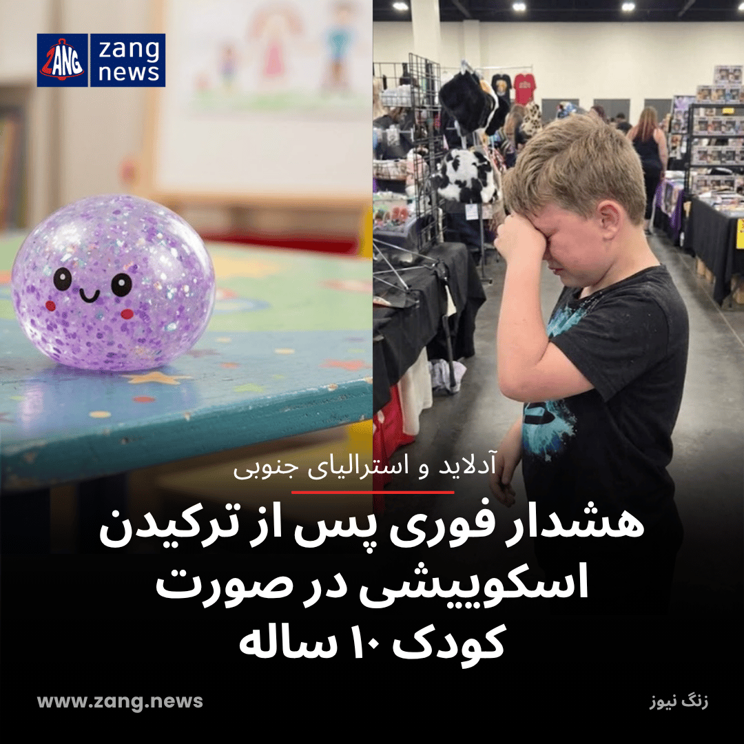 هشدار فوری پس از ترکیدن اسکوییشی در صورت کودک ۱۰ ساله