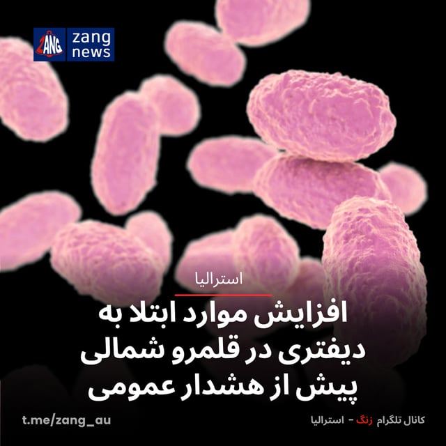 افزایش موارد ابتلا به دیفتری در قلمرو شمالی پیش از هشدار عمومی