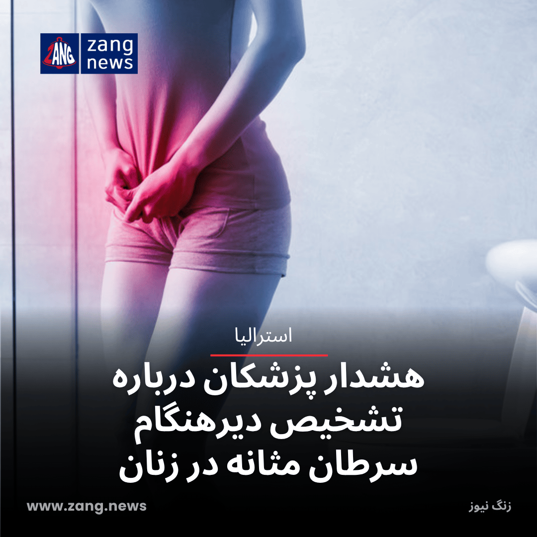 هشدار پزشکان درباره تشخیص دیرهنگام سرطان مثانه در زنان