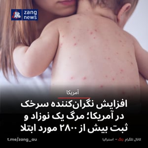 افزایش نگران‌کننده سرخک در آمریکا؛ مرگ یک نوزاد و ثبت بیش از ۲۸۰۰ مورد ابتلا