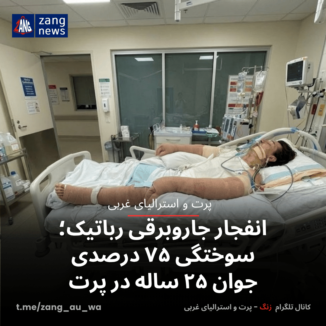 انفجار جاروبرقی رباتیک؛ سوختگی ۷۵ درصدی جوان ۲۵ ساله در پرت