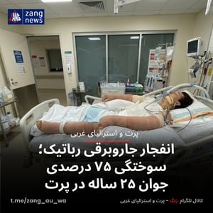 انفجار جاروبرقی رباتیک؛ سوختگی ۷۵ درصدی جوان ۲۵ ساله در پرت