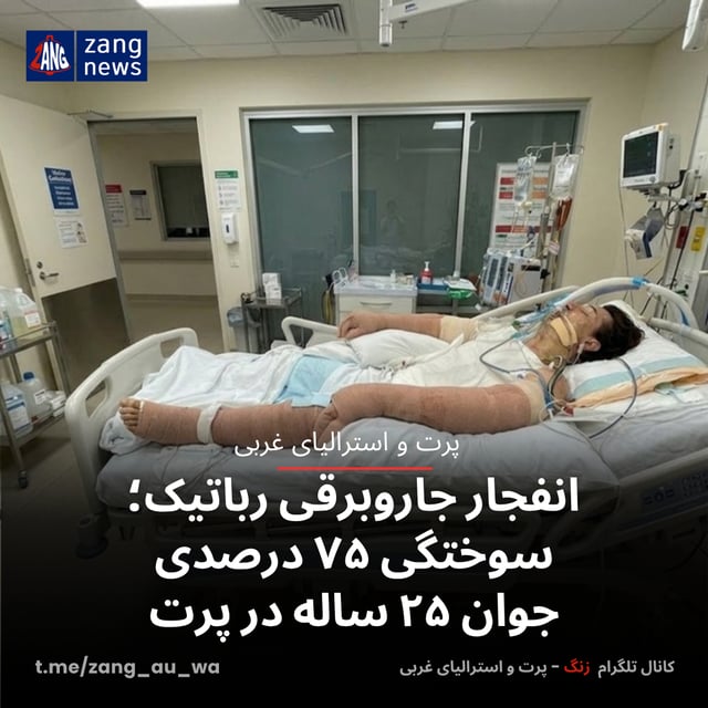 انفجار جاروبرقی رباتیک؛ سوختگی ۷۵ درصدی جوان ۲۵ ساله در پرت