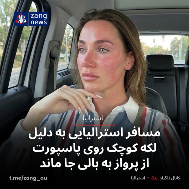 مسافر استرالیایی به دلیل لکه کوچک روی پاسپورت از پرواز به بالی جا ماند