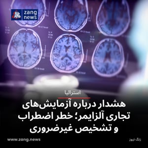 هشدار درباره آزمایش‌های تجاری آلزایمر؛ خطر اضطراب و تشخیص غیرضروری