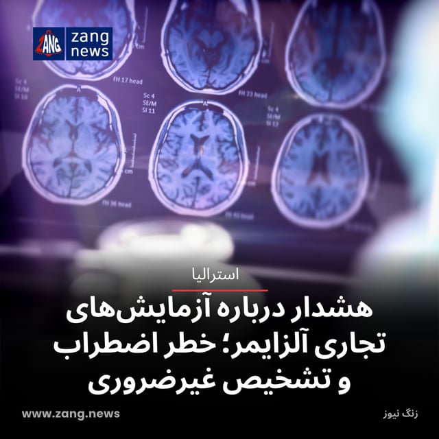 هشدار درباره آزمایش‌های تجاری آلزایمر؛ خطر اضطراب و تشخیص غیرضروری