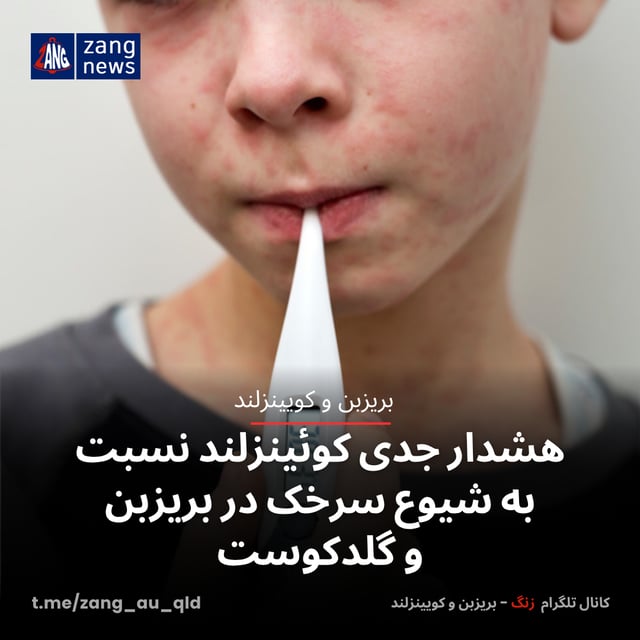هشدار جدی کوئینزلند نسبت به شیوع سرخک در بریزبن و گلدکوست