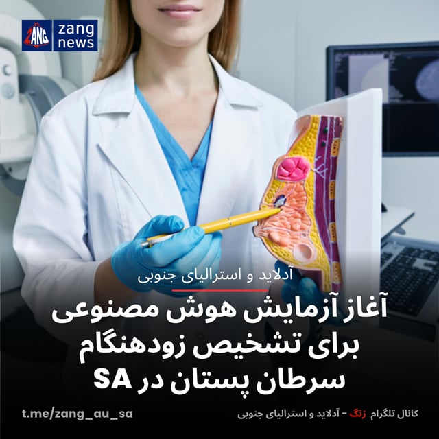 آغاز آزمایش هوش مصنوعی برای تشخیص زودهنگام سرطان پستان در SA