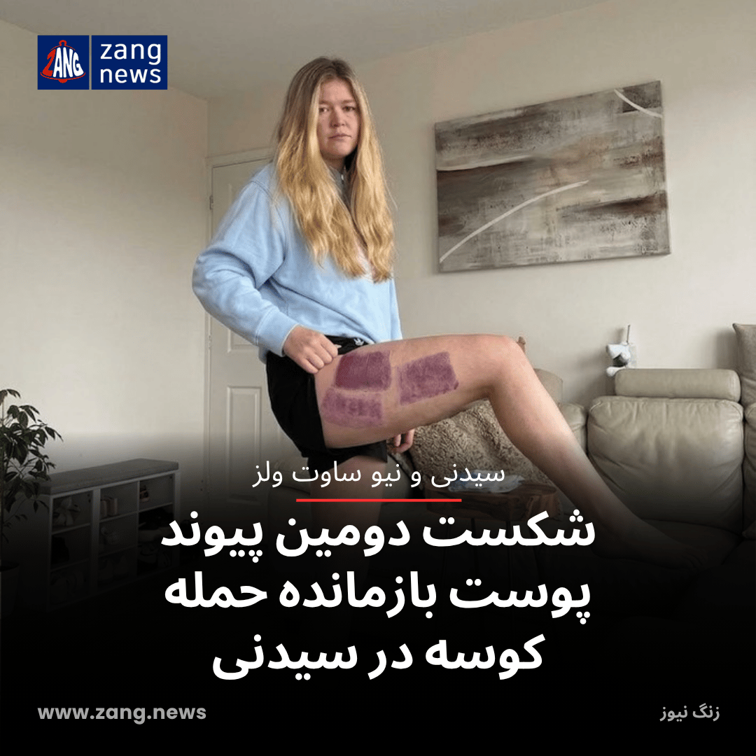 شکست دومین پیوند پوست بازمانده حمله کوسه در سیدنی
