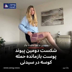 شکست دومین پیوند پوست بازمانده حمله کوسه در سیدنی