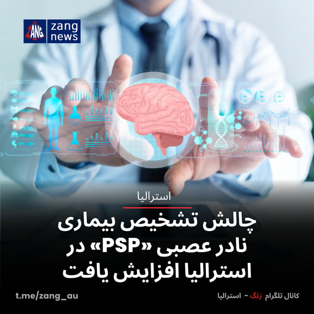 چالش تشخیص بیماری نادر عصبی «PSP» در استرالیا افزایش یافت