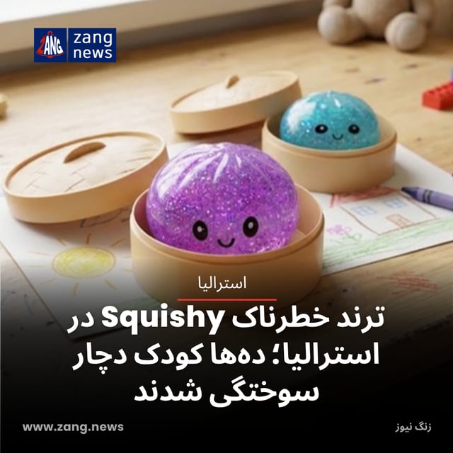 ترند خطرناک Squishy در استرالیا؛ ده‌ها کودک دچار سوختگی شدند