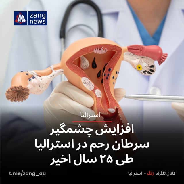 افزایش چشمگیر سرطان رحم در استرالیا طی ۲۵ سال اخیر