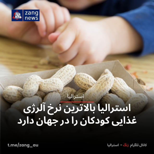 استرالیا بالاترین نرخ آلرژی غذایی کودکان را در جهان دارد