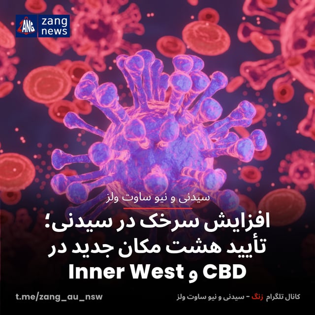 افزایش سرخک در سیدنی؛ تأیید هشت مکان جدید در CBD و Inner West